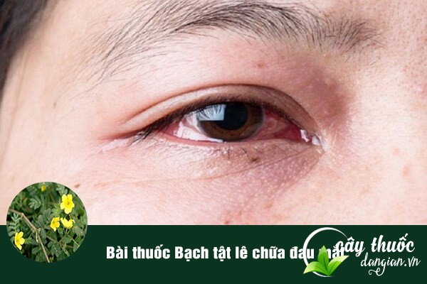 Bạch tật lê được sử dụng để làm bài thuốc chữa đau mắt, nước mắt chảy nhiều, thị lực giảm.