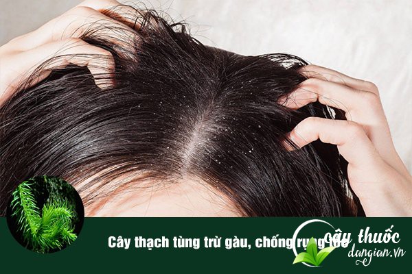 Bài thuốc cây thạch tùng giúp trị gàu, chữa rụng tóc được nhiều người áp dụng.
