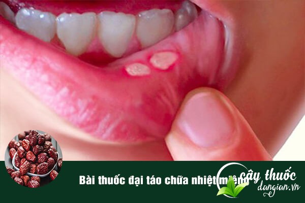 Đại táo thường được dùng trong bài thuốc chữa nhiệt miệng rất tốt.