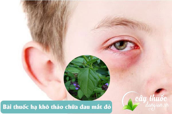 Hạ khô thảo được sử dụng để chữa đau mắt đỏ hiệu quả