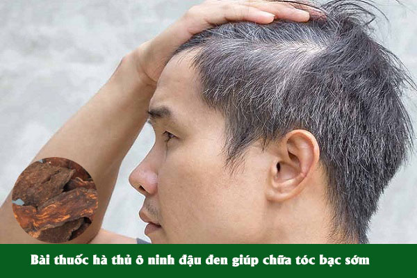 Bài thuốc Hà thủ ô ninh đậu đen chữa tóc bạc sớm được nhiều người áp dụng