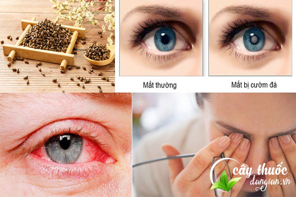 Bài thuốc hạt muồng chữa bệnh về mắt